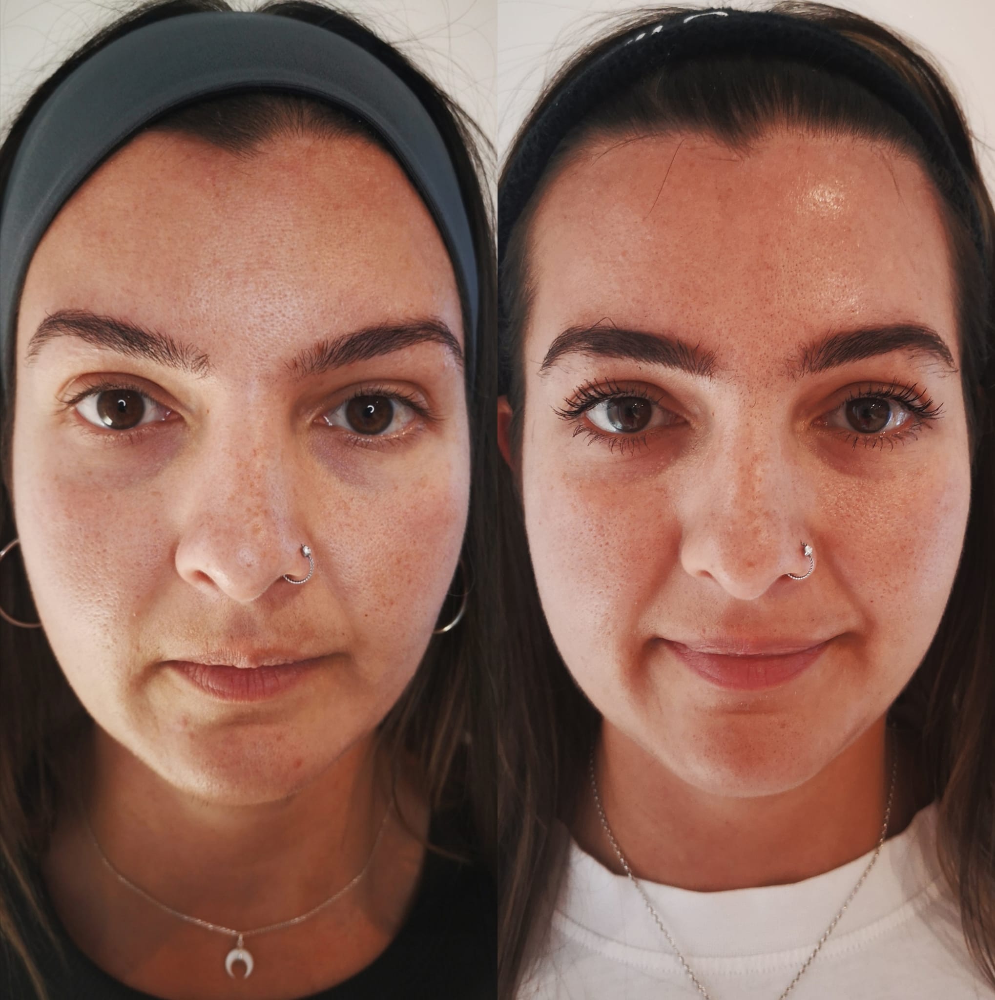 Treatment for Proactive Anti-Aging